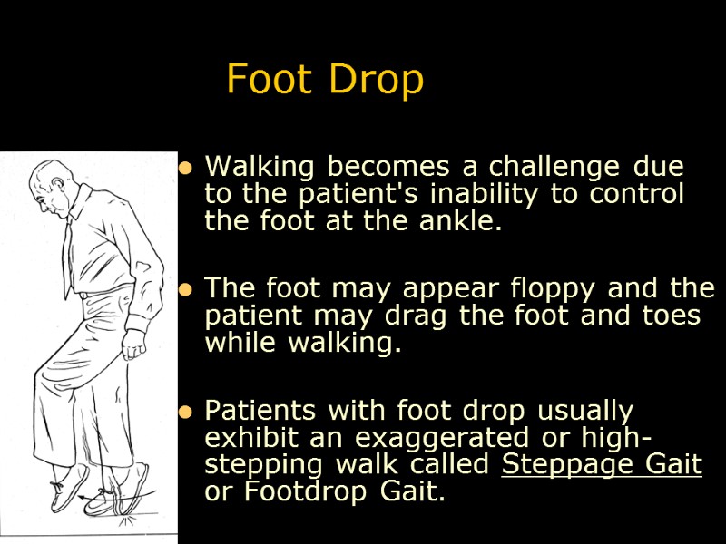 Foot Drop Walking becomes a challenge due to the patient's inability to control the